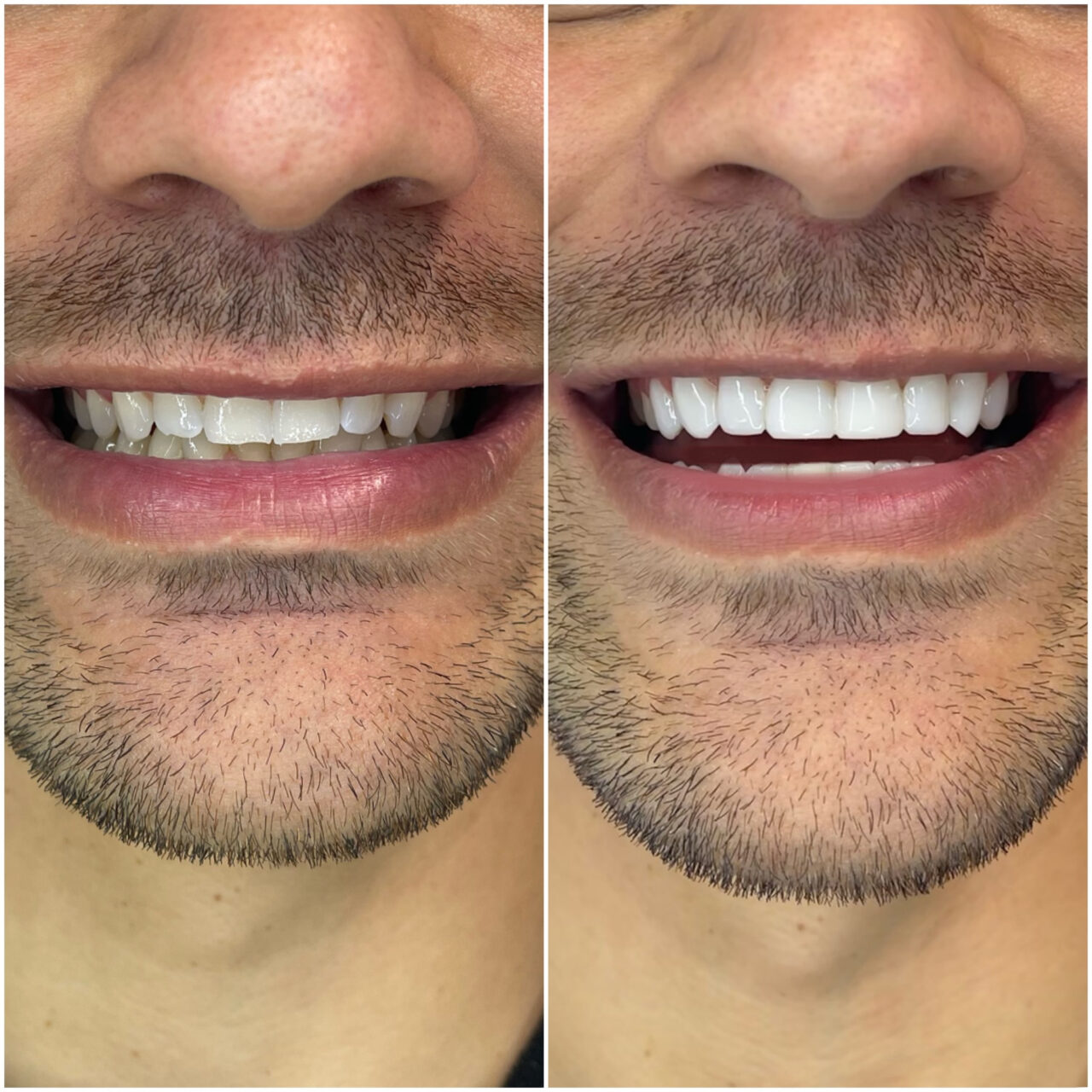 fede-horiz https://topdental.com.ar/wp-content/uploads/2025/11/fede-horiz-1280x1280.jpeg